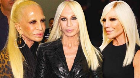 donatella versace early days|what happened to donatella versace's face.